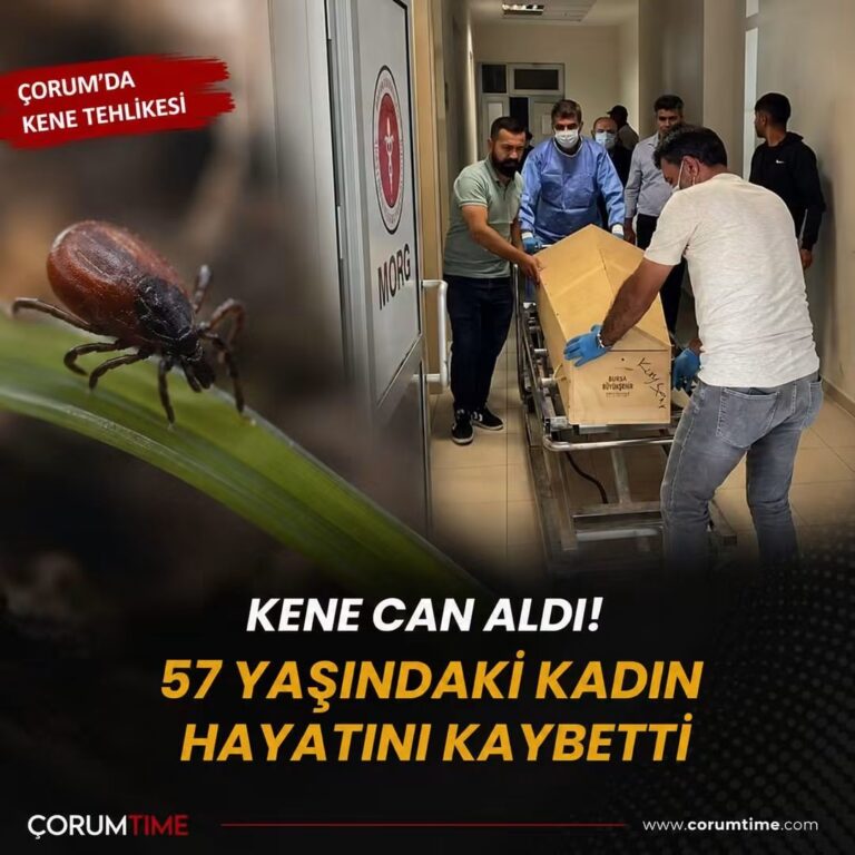 Çorum’da Kene Tehlikesi Can Aldı: 57 Yaşındaki Kadın KKKA Nedeniyle Hayatını Kaybetti